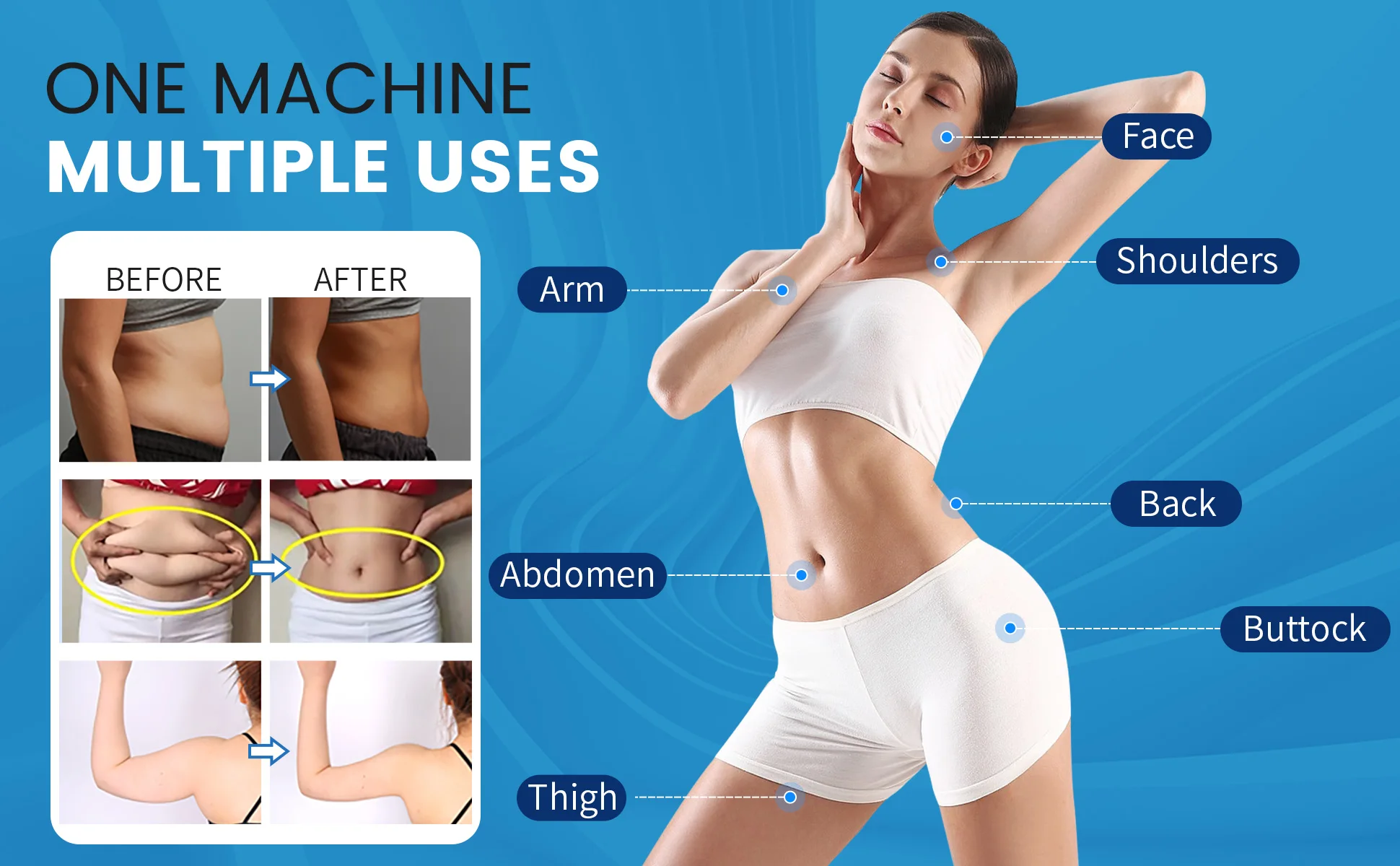 MYOslim roller system applied for blood circulation and massage